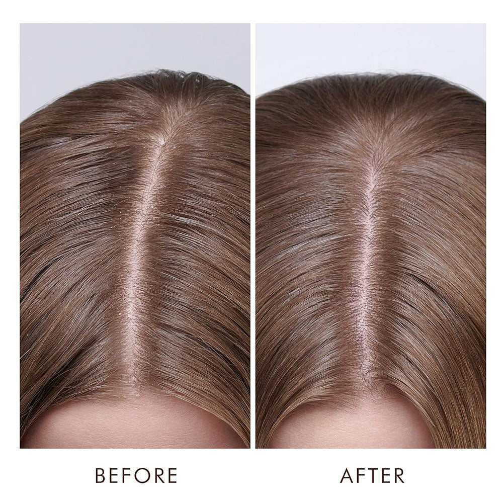 Moroccanoil Dry Scalp Treatment 1.5oz SDNM01 21165
