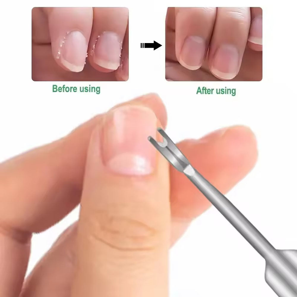Cuticle Remover Pusher Surgical Grade Stainless Steel 25010