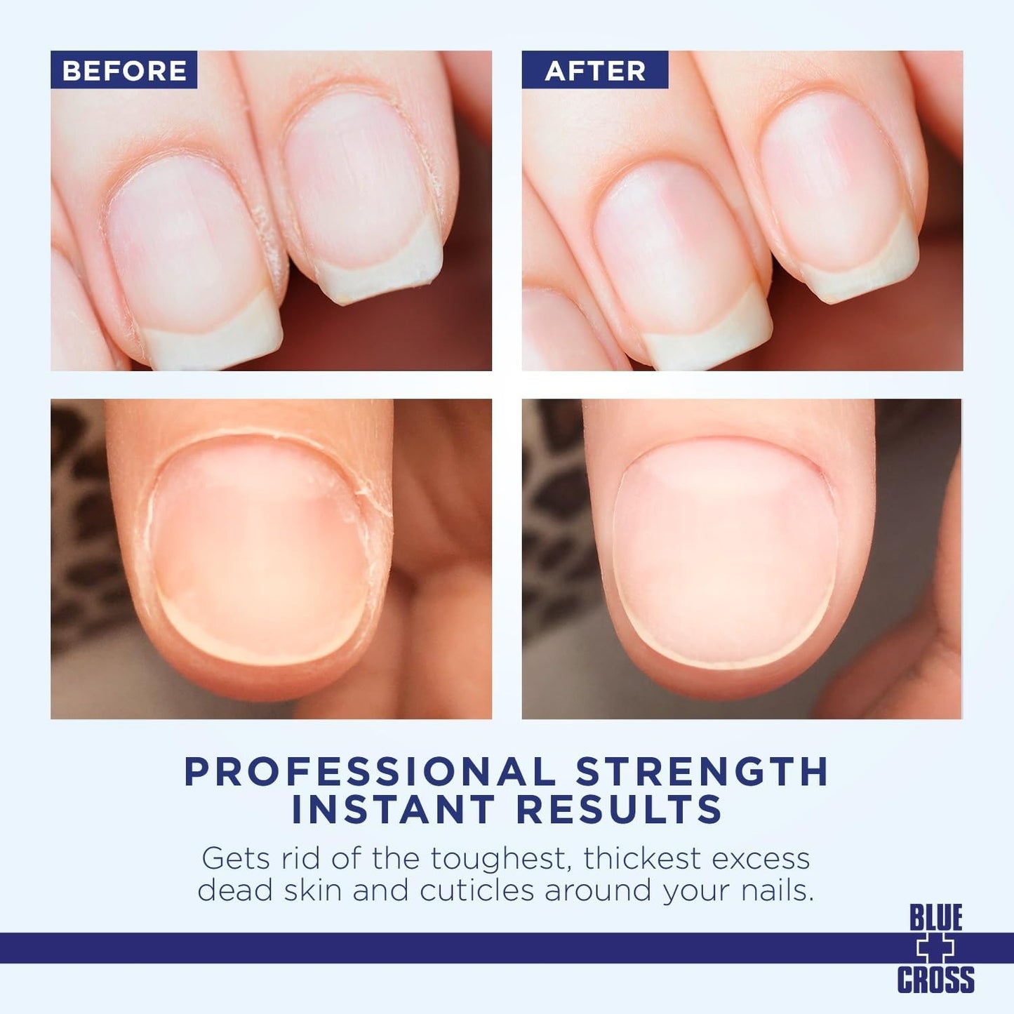 Blue+Cross Cuticle Remover 32 fl oz/ 946 ml #132 71236