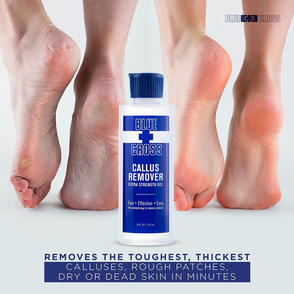 Blue+Cross Callus Remover 6 Fl. Oz 117 ml 71251