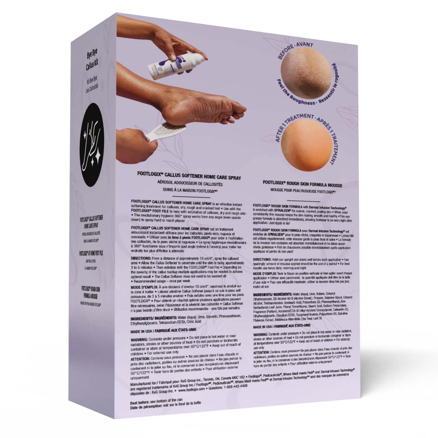 Footlogix Bye Bye Callus Kit 01663