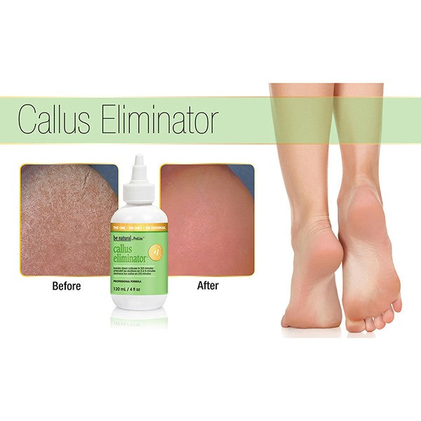Be Natural Callus Eliminator 1 Gallon #21390 00120